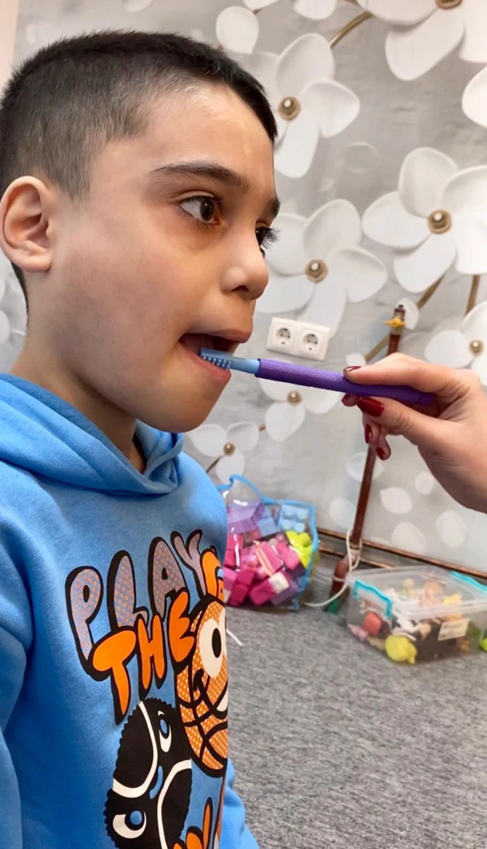 15.000 de euro - Intervenția care poate schimba destinul unui copil cu autism și crize epileptice