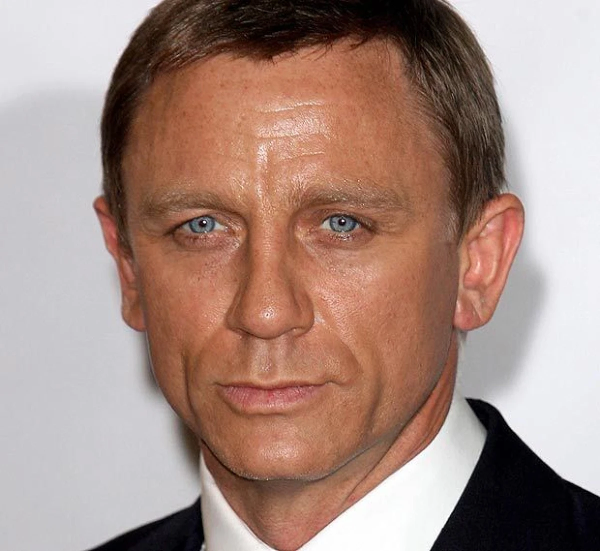 ACTORUL DANIEL CRAIG S-A RANIT IN TIMPUL FILMARILOR LA "JAMES BOND" SI VA FI OPERAT