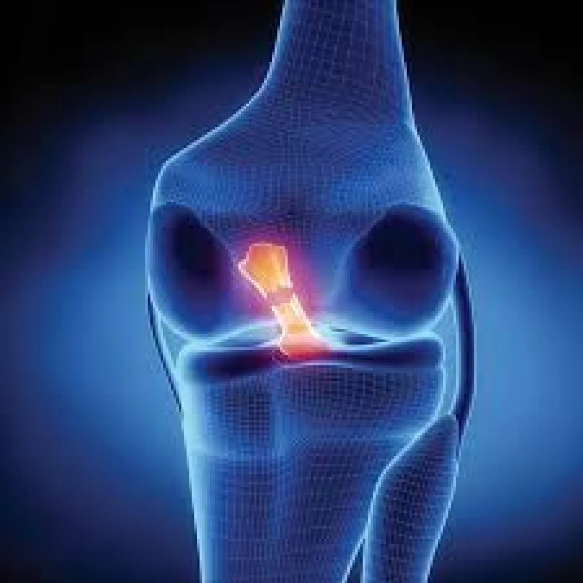 AI PROBLEME CU LIGAMENTELE SI TENDOANELE? INCEARCA ACEASTA BAUTURA