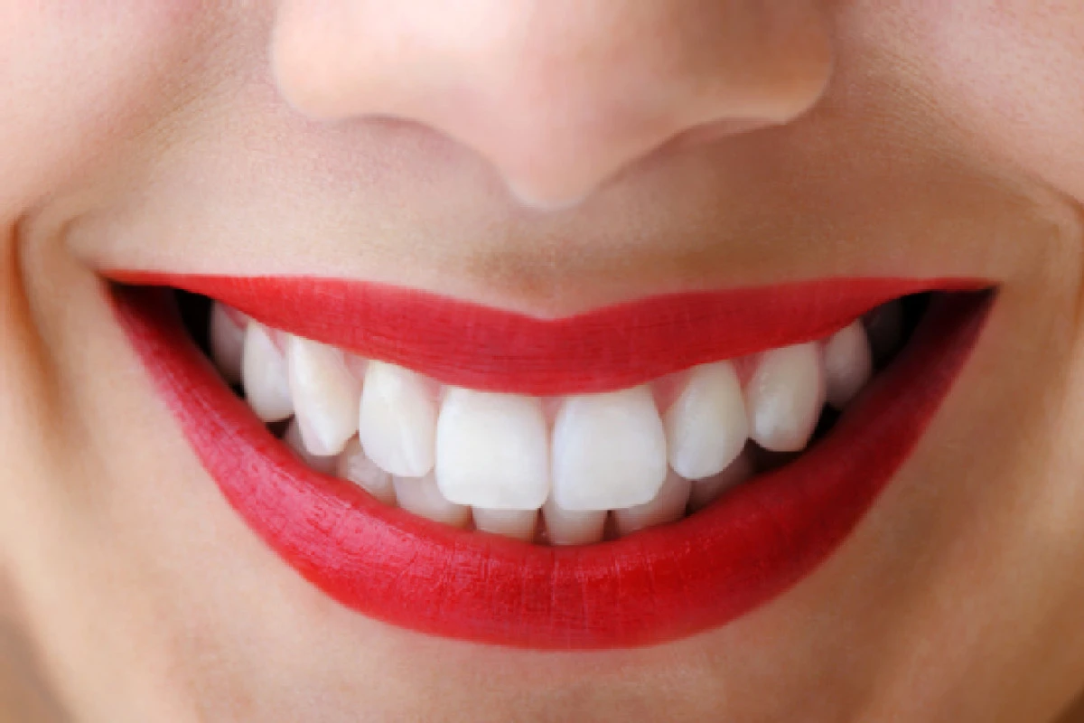ALIMENTE CARE ITI ALBESC DINTII SI ITI PROTEJEAZA GINGIILE