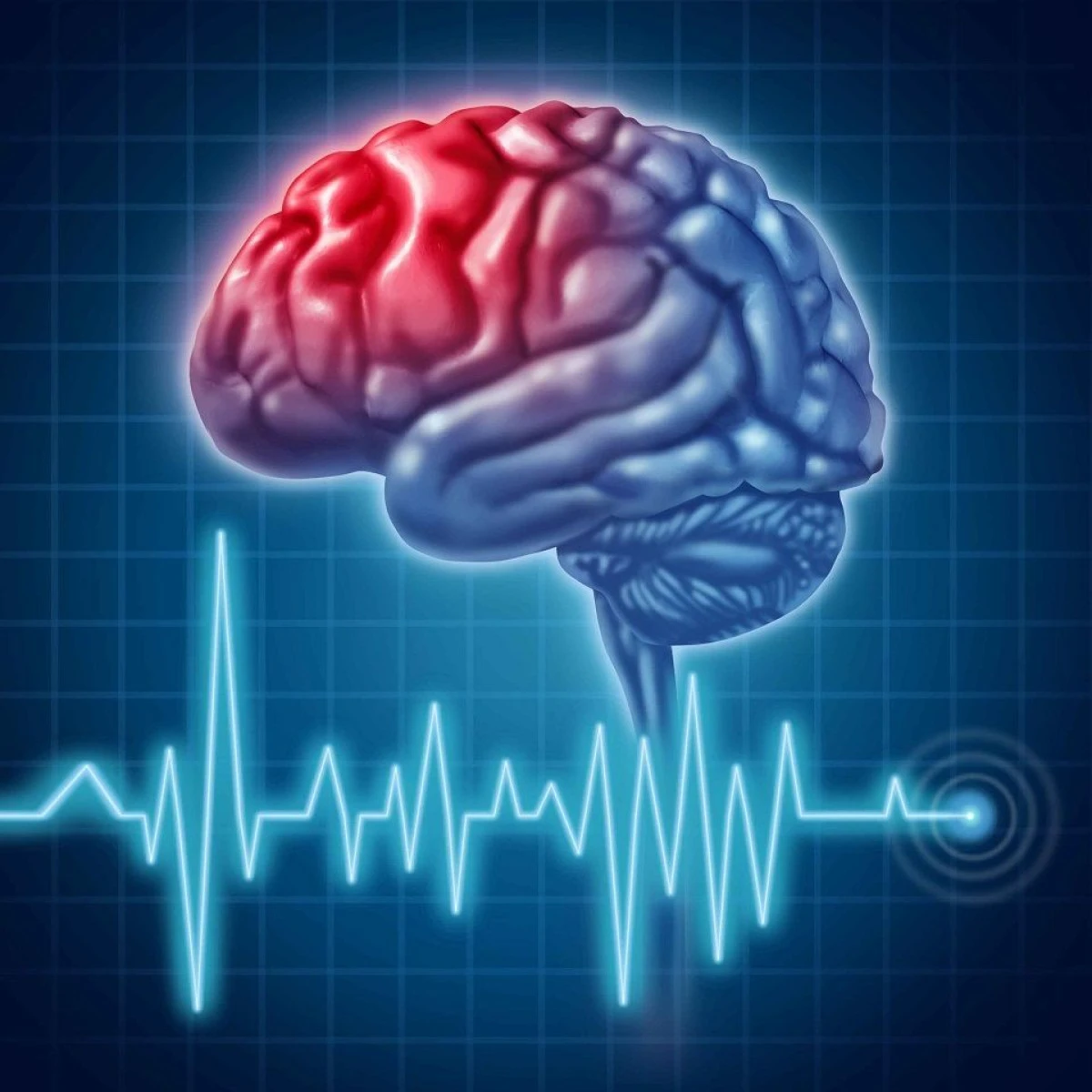 ALIMENTELE BOGATE ÎN POTASIU REDUC RISCUL DE ACCIDENT VASCULAR CEREBRAL