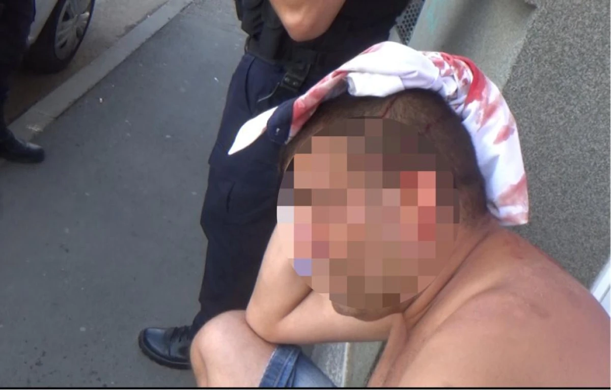 Arădean lovit cu o cărămidă în cap, pe fondul unor neînțelegeri mai vechi