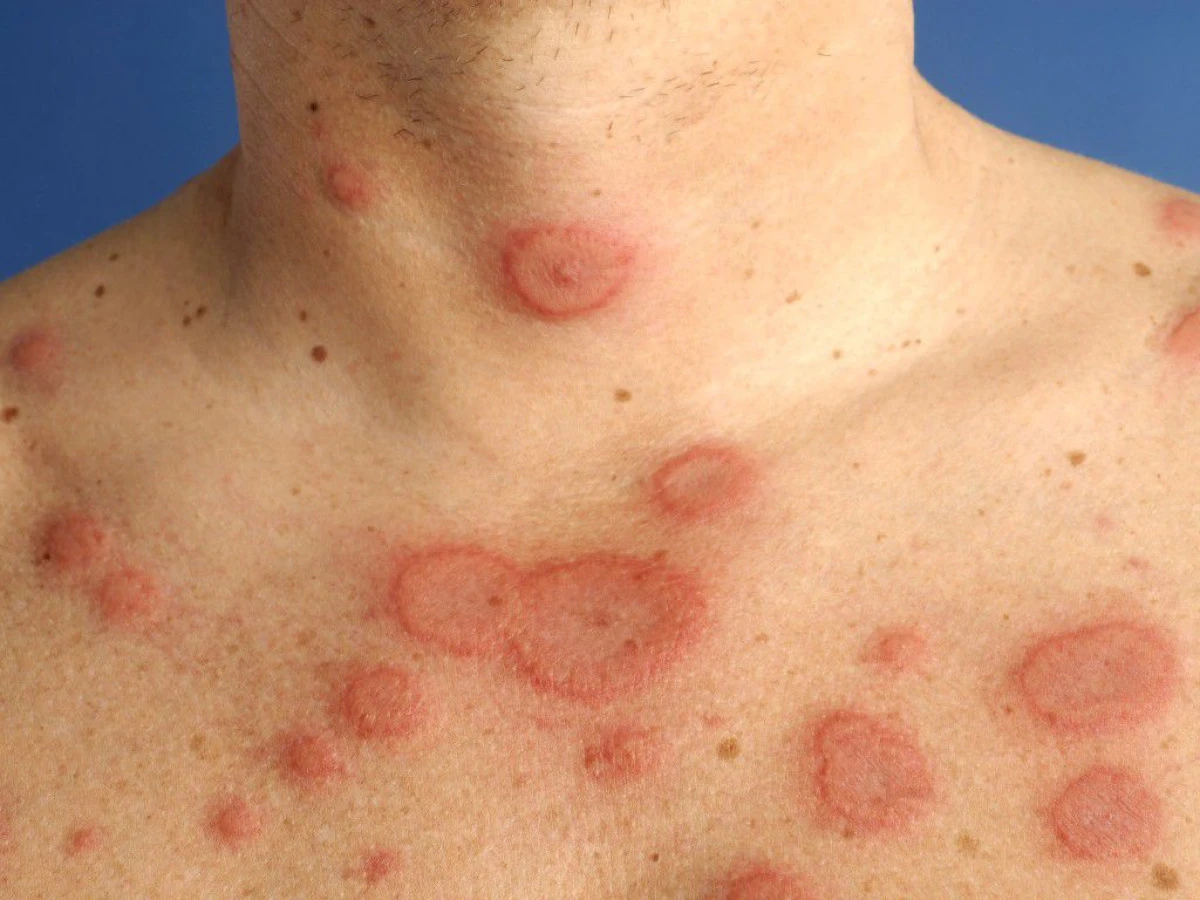 Boală extrem de contagioasă la granița cu Ucraina. Măsuri luate de Ministerul Sănătății