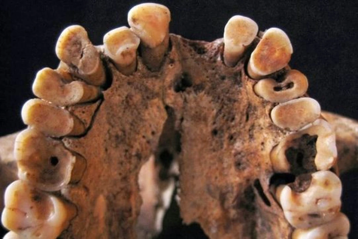 CAT DE VECHE ESTE DE FAPT STOMATOLOGIA: PRIMA DOVADA A INTERVENTIEI UNUI DENTIST