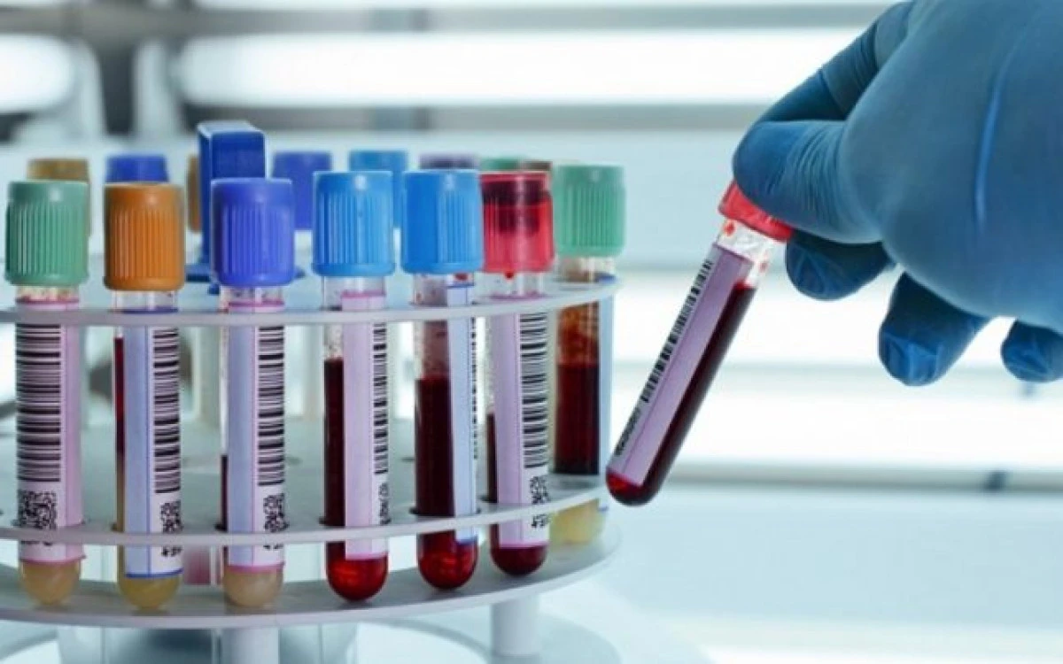 Ce analize medicale nu ar trebui neglijate