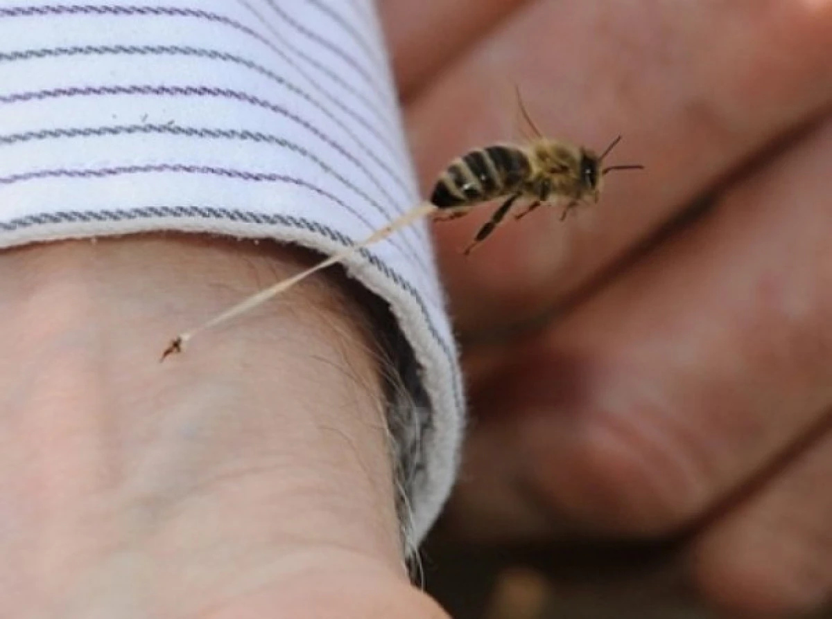 Ce trebuie să faci când te-a înțepat o insectă