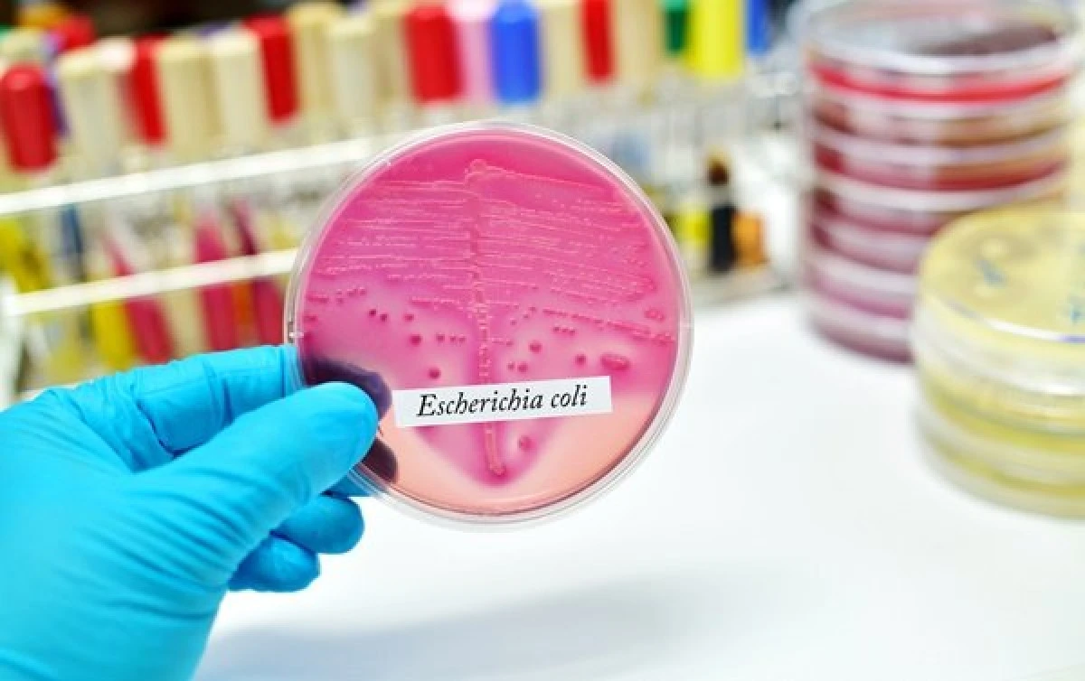 Cum știi că te-ai infectat cu E.coli