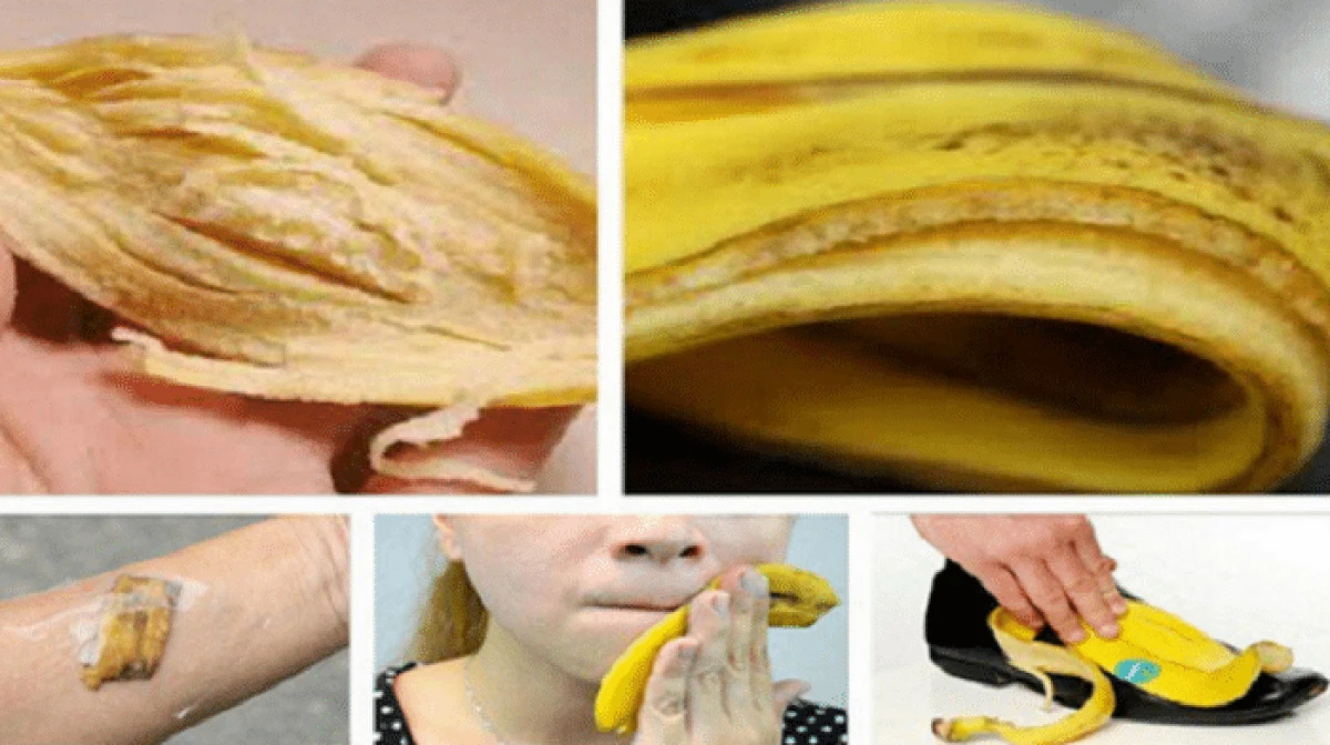 De n-ar trebui să arunci cojile de banane