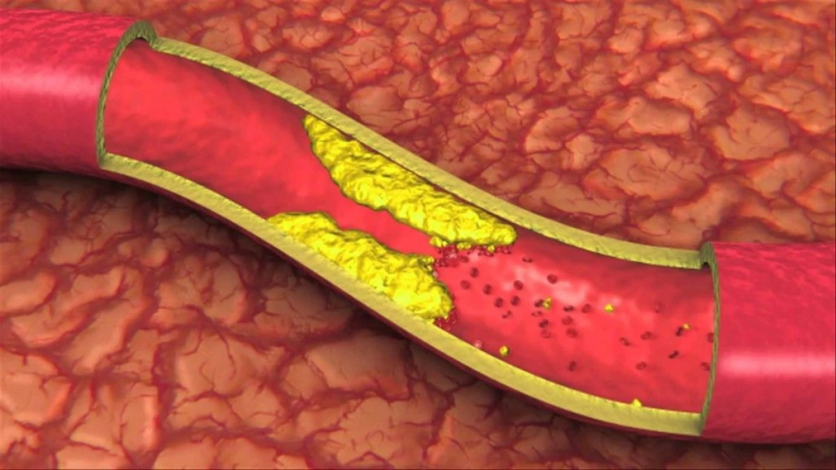 Diete care duc la probleme cardiovasculare