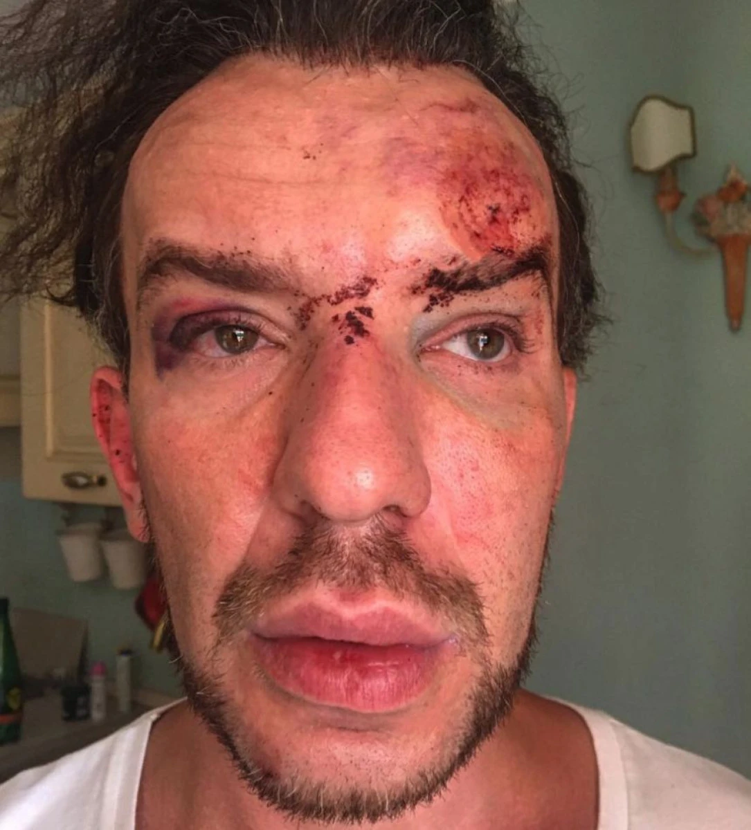 Femeile care l-au bătut pe designerul Stephan Pelger au fost arestate