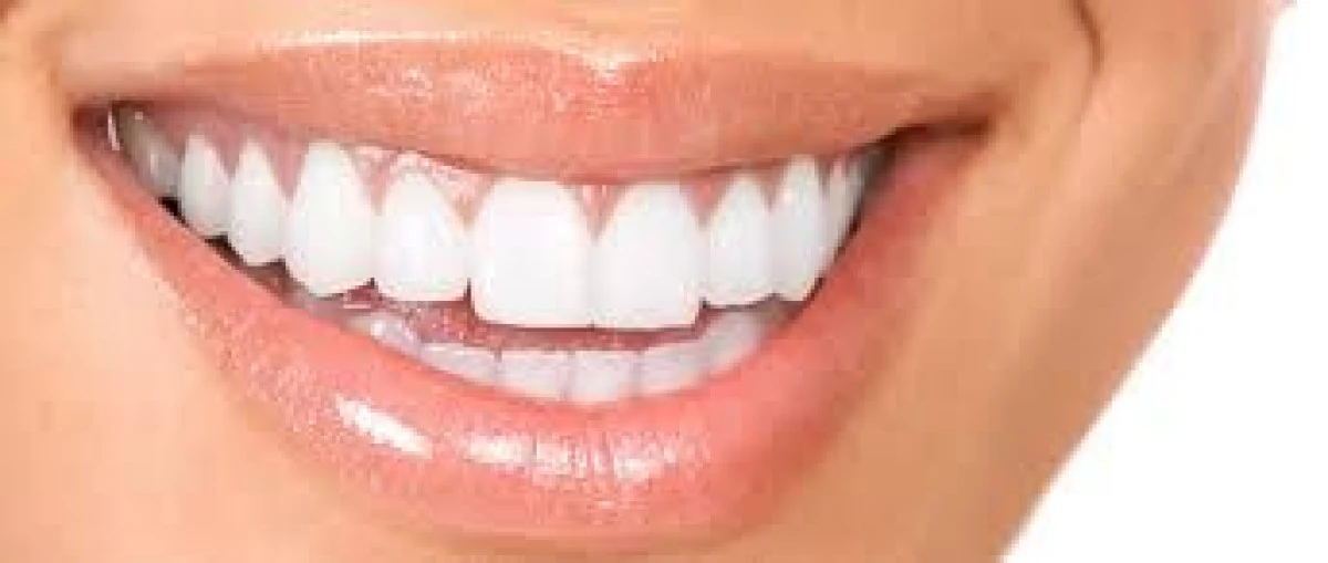 IMPLANTUL DENTAR VERSUS PUNTEA DENTARA
