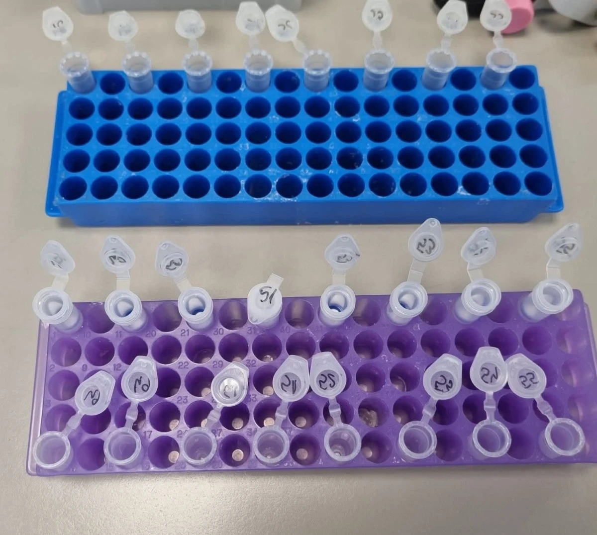 Institutul Cantacuzino confirmă: pacient infectat cu hantavirus, la Arad