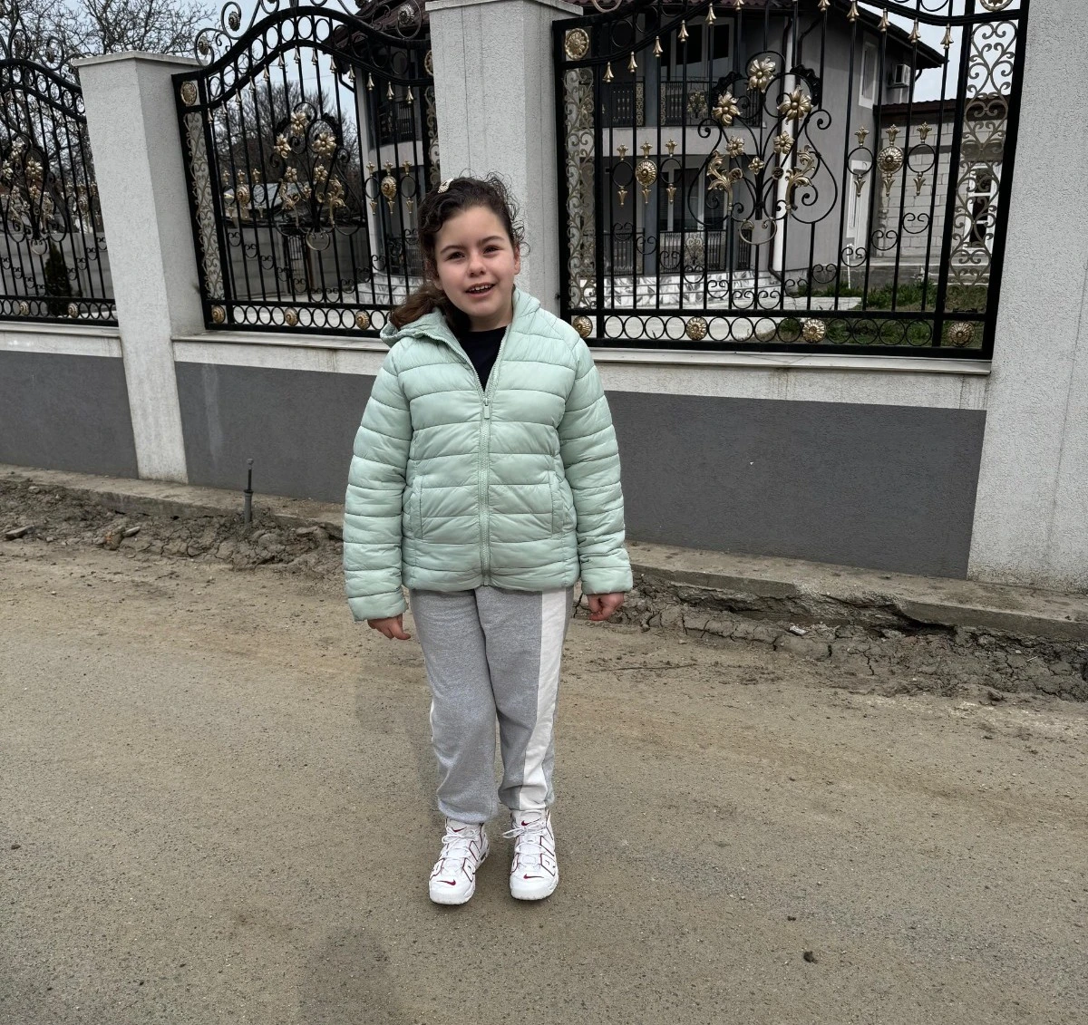 La 12 ani, Larisa a trecut prin 14 anestezii și mai multe operații. În septembrie urmează intervenția care ar putea pune capăt anilor de suferință