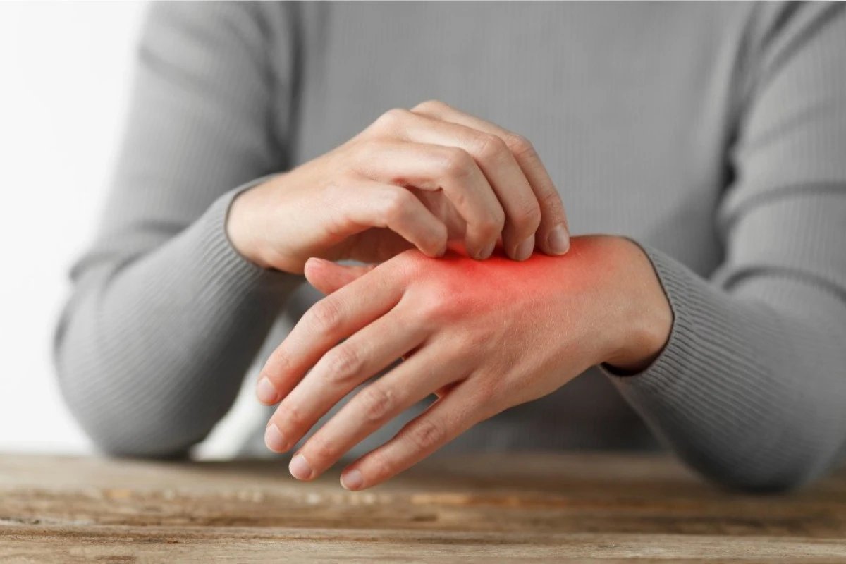 Leziunile cutanate și bolile intestinale – ce legături există între ele?
