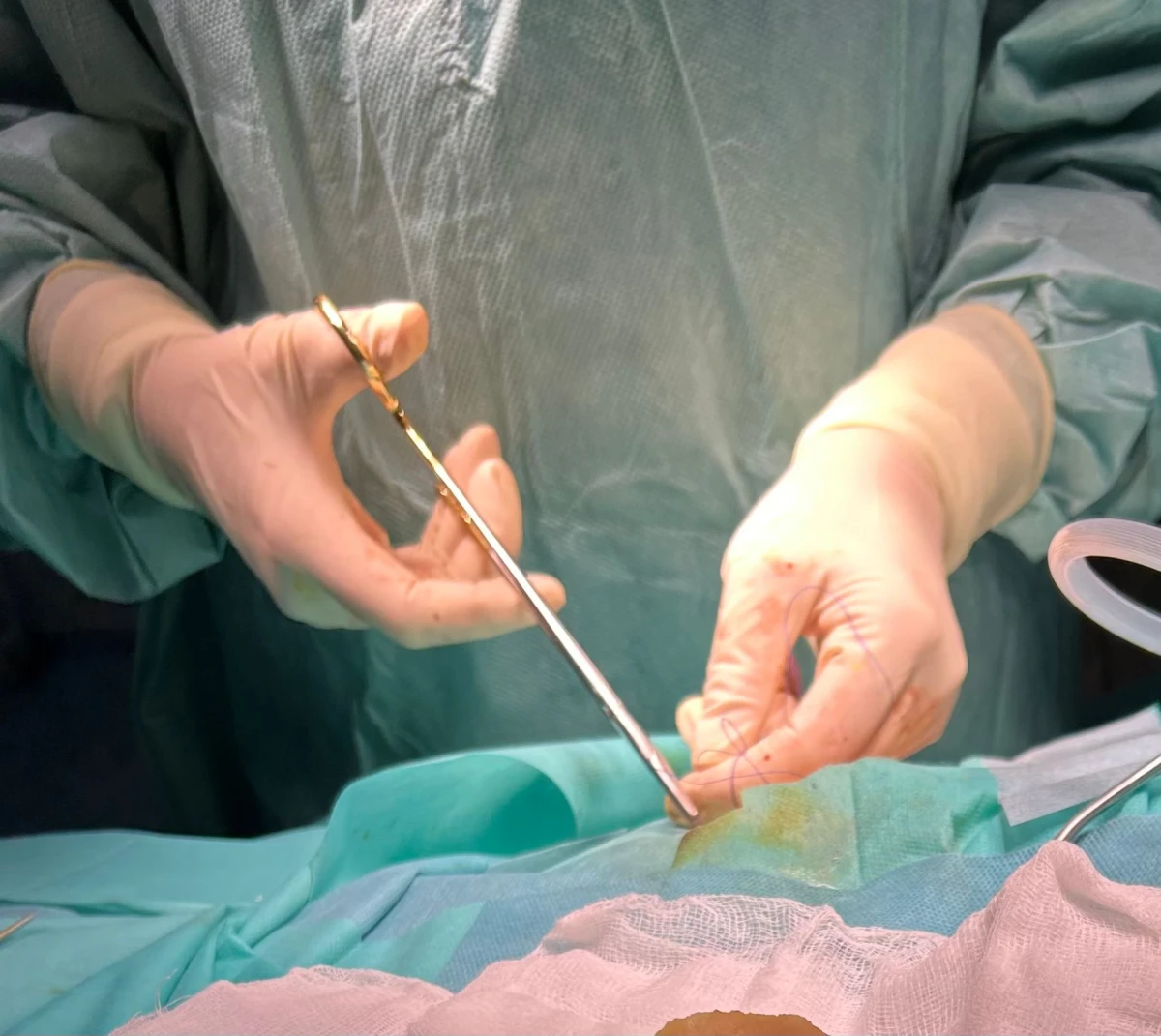 Medicii arădeni au salvat o tânără mamă de 29 de ani, diagnosticată cu o tumoră cerebrală agresivă