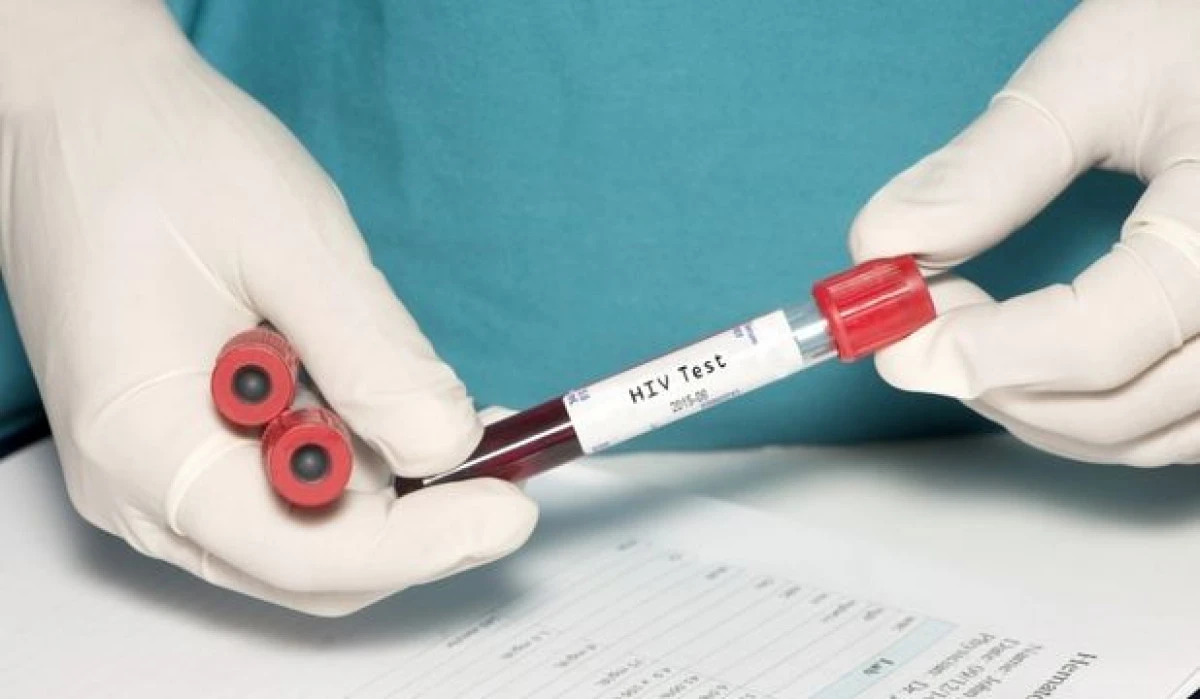 OMENIREA A ATINS AL SASELEA OBIECTIV AL MILENIULUI. CE SE VA INTAMPLA CU VIRUSUL HIV PANA IN 2030