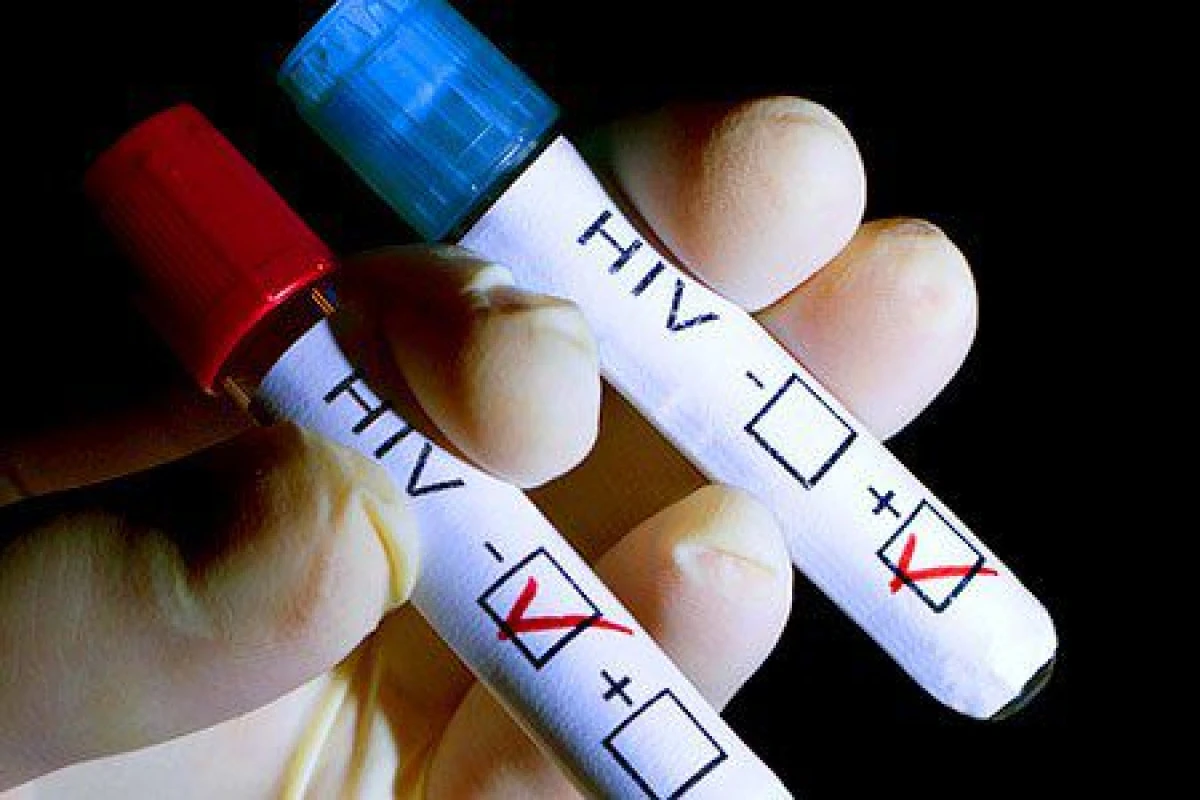 Peste 500 de cazuri noi de infecţie cu HIV au fost diagnosticate în acest an