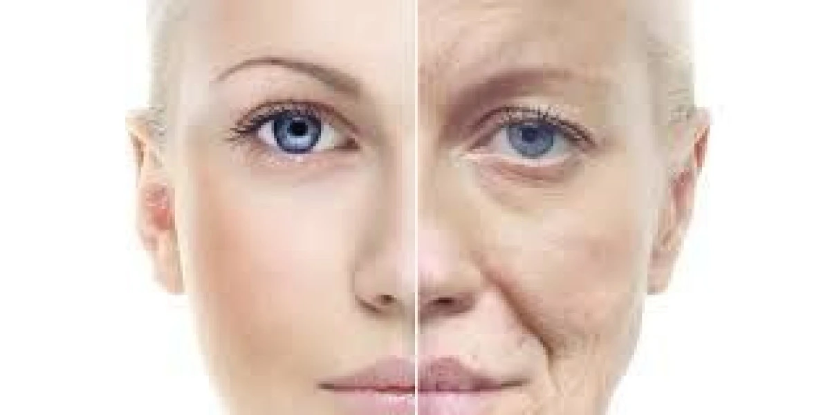 REMEDII NATURALE CARE PREVIN ÎMBĂTRÂNIREA PIELII