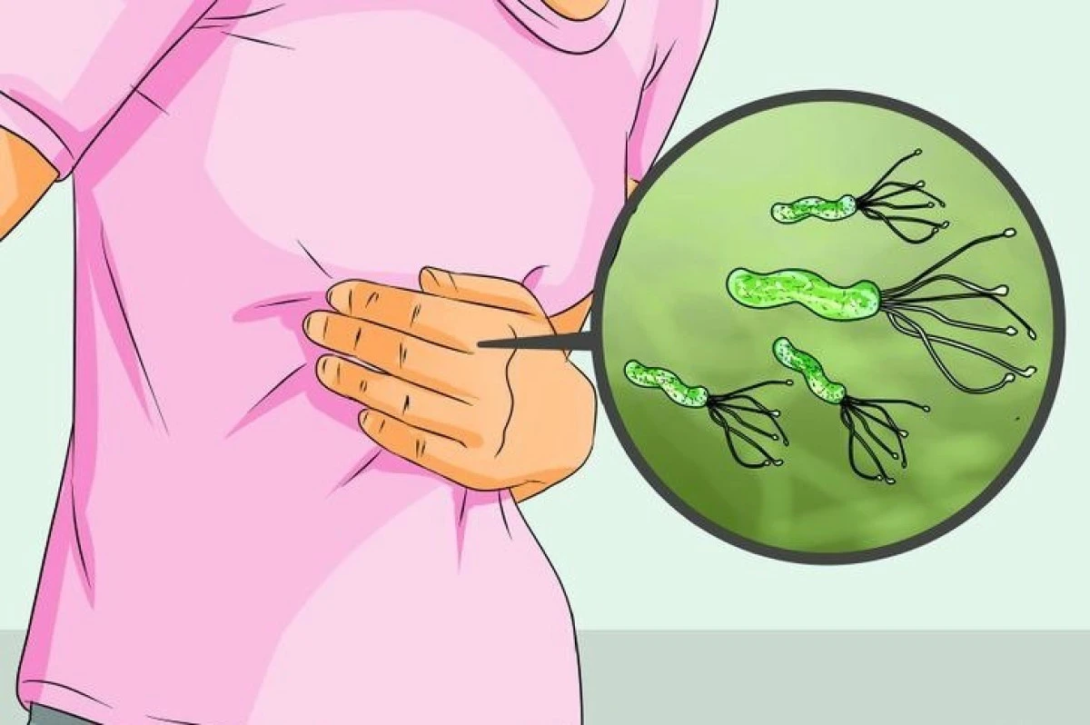 Remedii naturiste pentru Helicobacter pylori, boala care afectează aproximativ 50% din populația lumii