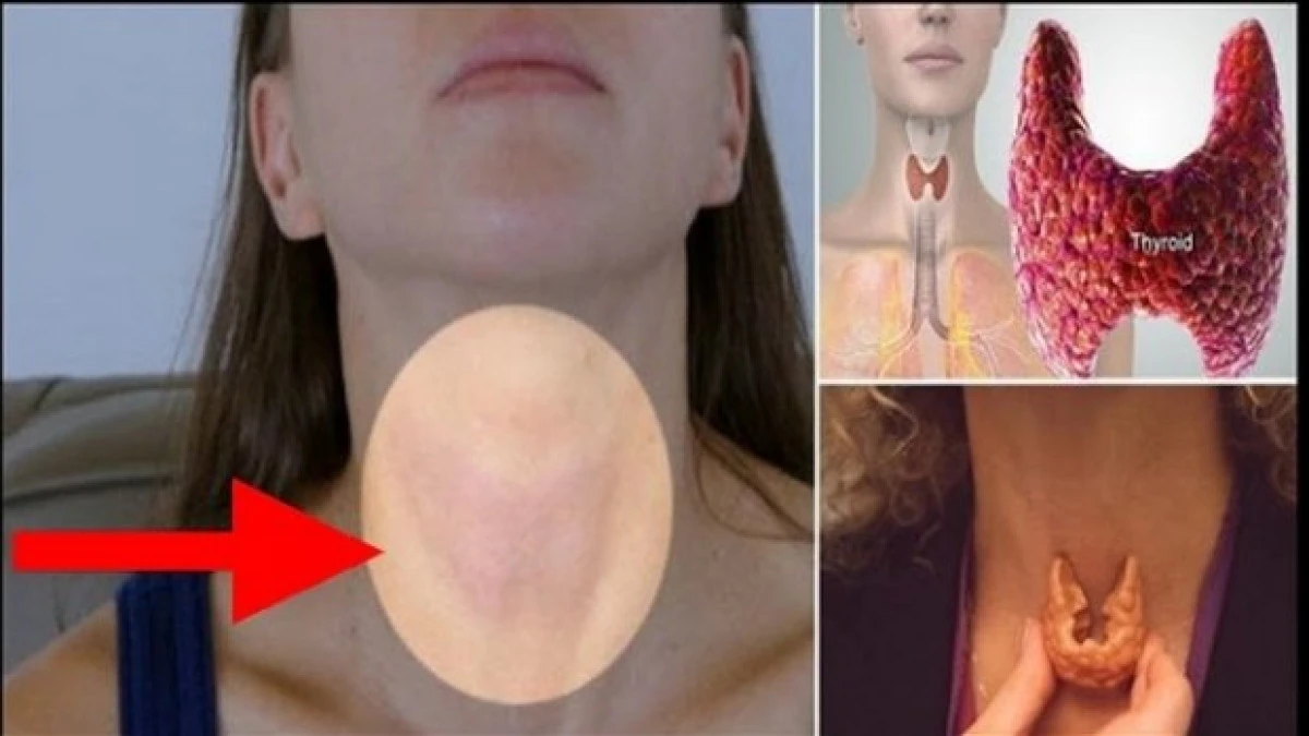 Remediul natural care ”repornește” tiroida