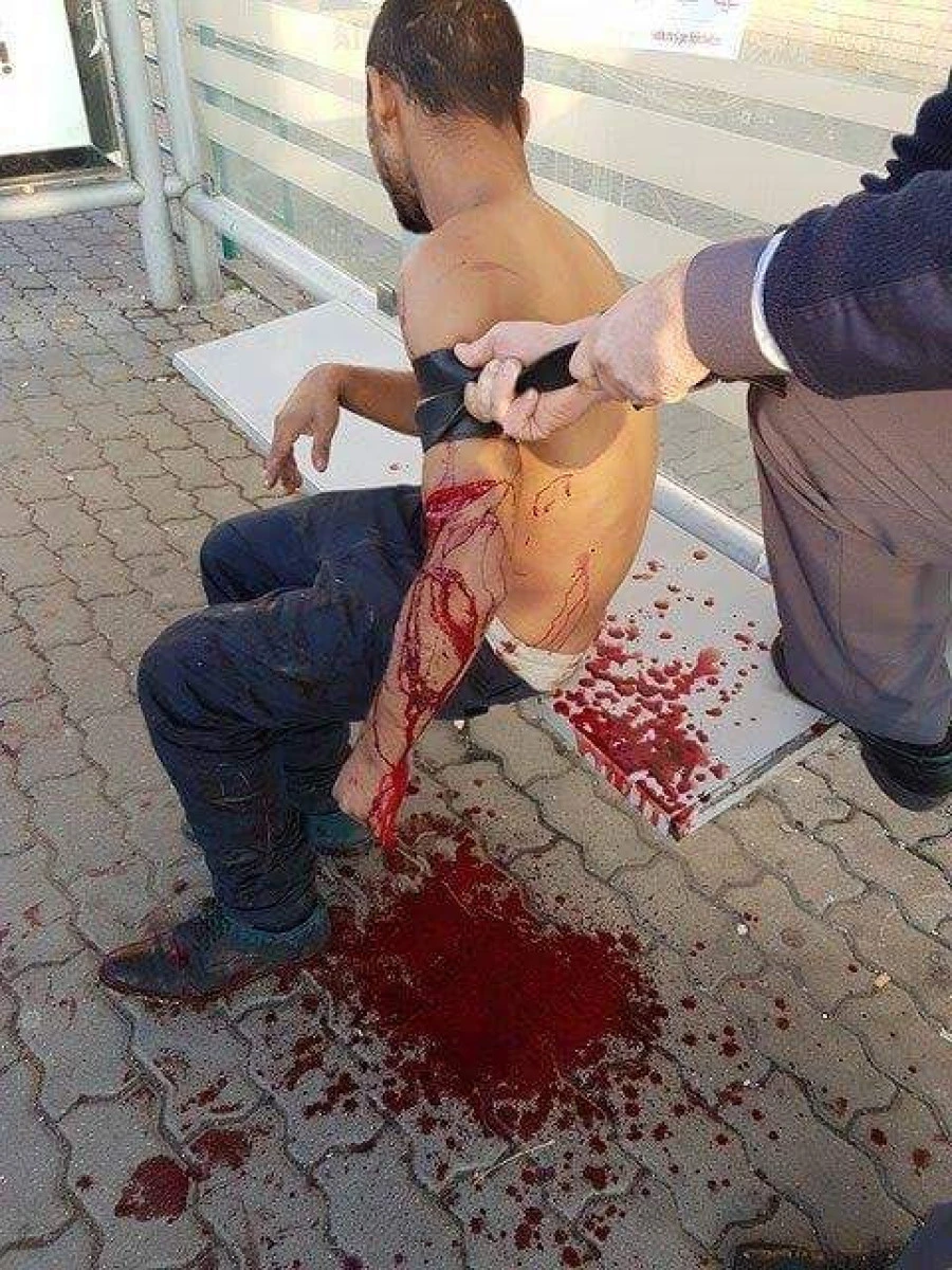 SCENE DE GROAZĂ ÎN CENTRUL ARADULUI. UN TÂNĂR ȘI-A TĂIAT VENELE CU UN CIOB DE STICLĂ
