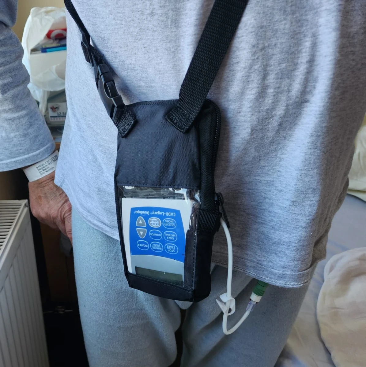 Spitalul Județean Arad introduce un tratament inovator pentru pacienții cu Parkinson avansat