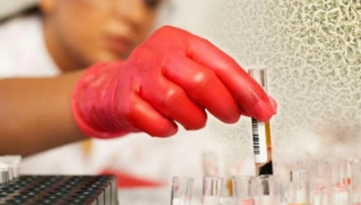 Testul prin care cancerul poate fi depistat în 10 minute