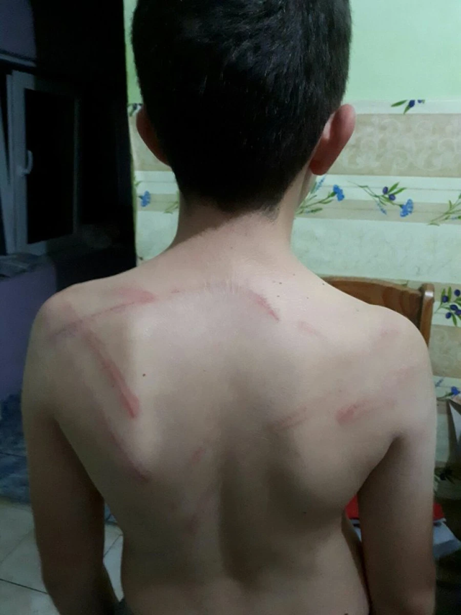 Un copil de 9 ani a fost bătut cu sălbăticie de tatăl său. Bărbatul a ajuns în arestul IPJ Arad