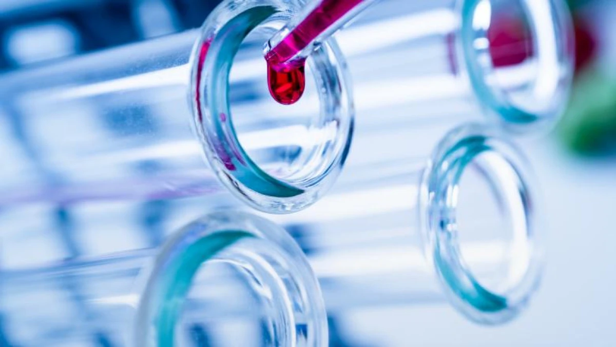 Un nou test de sânge ar putea depista cancerul cu patru ani înainte ca simptomele să apară