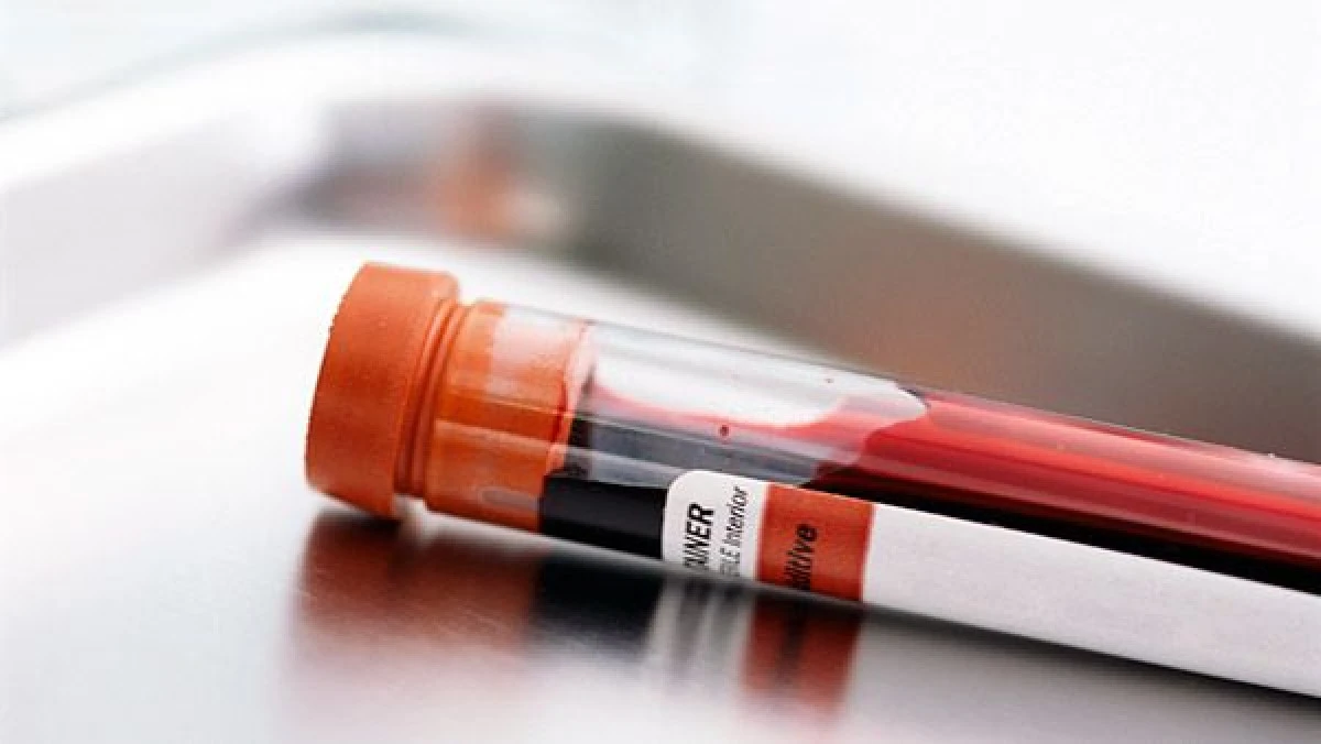 UN TRATAMENT EXPERIMENTAL A VINDECAT COMPLET UN PACIENT INFECTAT CU HIV