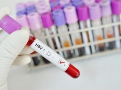 14 țări au confirmat cazuri de hepatită misterioasă