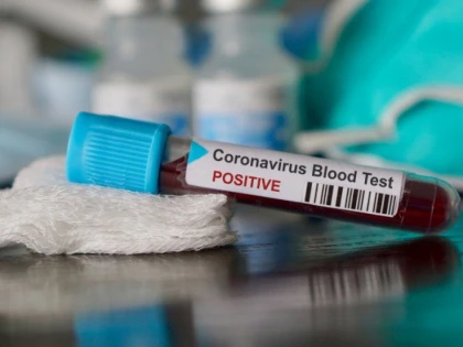 2.668 de cazuri noi de COVID-19, dintre care 44 în județul Arad