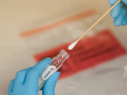 24 de arădeni au fost reconfirmaţi pozitiv