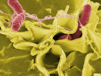 5 BACTERII CARE TE POT UCIDE