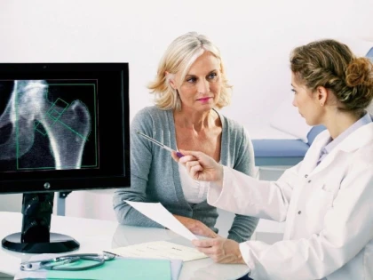 ADMINISTRAREA CORECTĂ A MEDICAMENTELOR PENTRU OSTEOPOROZĂ