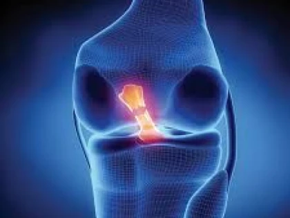 AI PROBLEME CU LIGAMENTELE SI TENDOANELE? INCEARCA ACEASTA BAUTURA