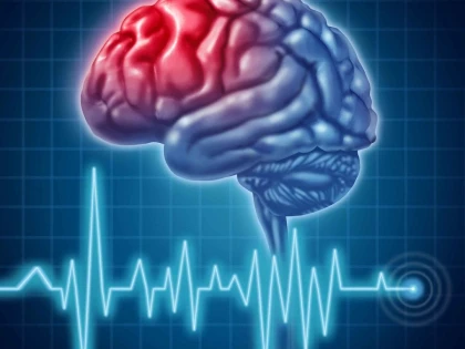 ALIMENTELE BOGATE ÎN POTASIU REDUC RISCUL DE ACCIDENT VASCULAR CEREBRAL