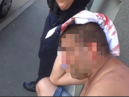 Arădean lovit cu o cărămidă în cap, pe fondul unor neînțelegeri mai vechi