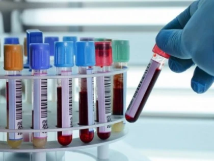 Ce analize medicale nu ar trebui neglijate