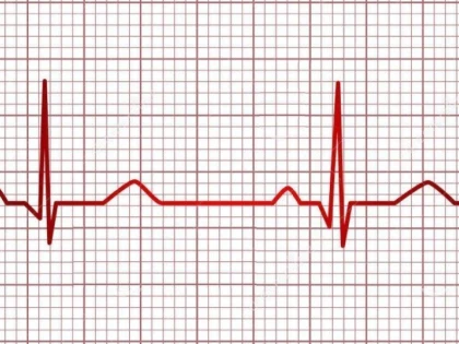 Ce este și când trebuie făcută electrocardiograma