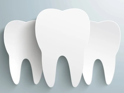 Ce factori trebuie sa iei in considerare cand vrei sa calculezi costul unui implant dentar?