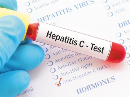 Ce trebuie să știm despre hepatita C