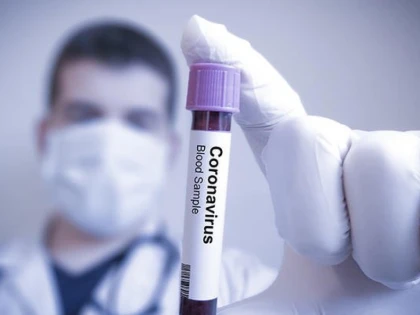 Coronavirus: 18 noi infectări în județul Arad