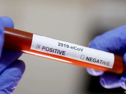 Coronavirus: 19 comune și orașe din județul Arad sunt în zona roșie