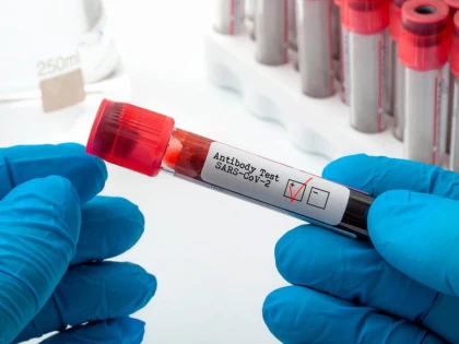 Coronavirus: Municipiul Arad se apropie de zona verde