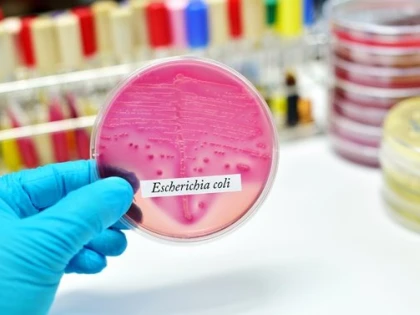 Cum știi că te-ai infectat cu E.coli
