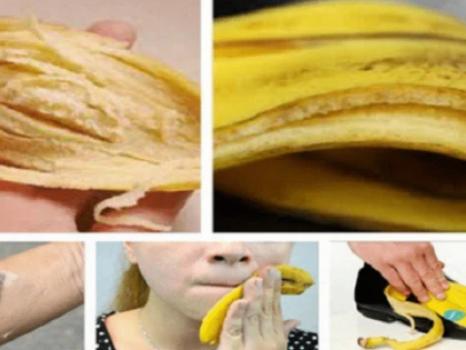 De n-ar trebui să arunci cojile de banane