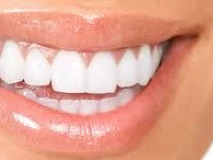 IMPLANTUL DENTAR VERSUS PUNTEA DENTARA