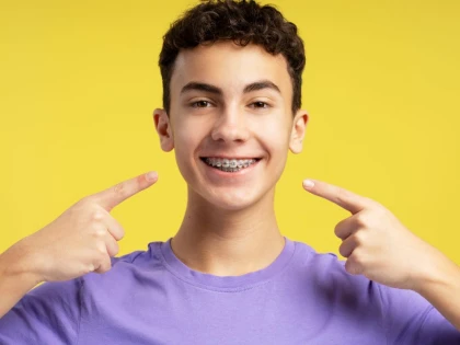 Îngrijirea ortodontică pentru adolescenți: ce trebuie să știi despre aparatele dentare