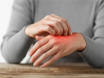 Leziunile cutanate și bolile intestinale – ce legături există între ele?